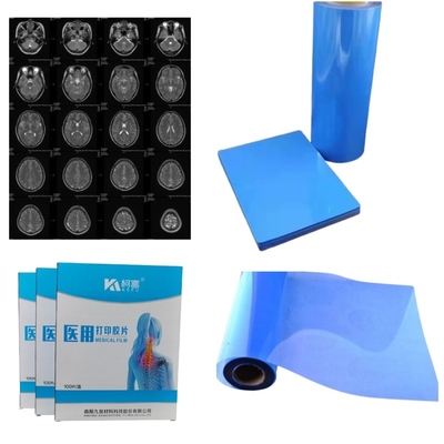 Film à rayons X PET de haute netteté pour la fabrication de dispositifs médicaux
