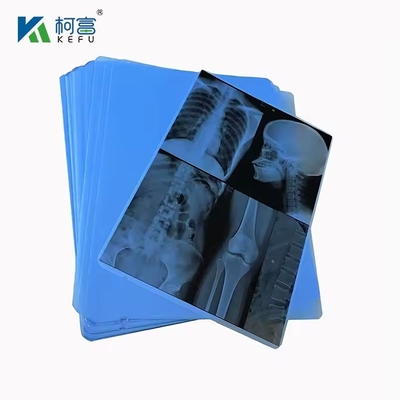 Films de haute qualité pour rayons X médicaux 8*10in\20*25cm pour rayons X