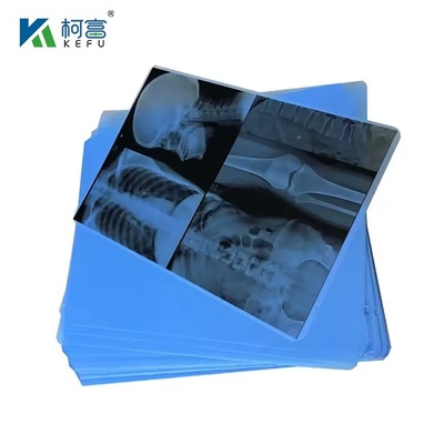 A4 encre médicale Jet film bleu X-ray PET film papier X-ray