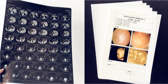 Produits médicaux Film d'impression laser Blanc opaque Film médical à rayons X Film d'impression d'image Pour l'imprimante à jet d'encre Epson et Canon