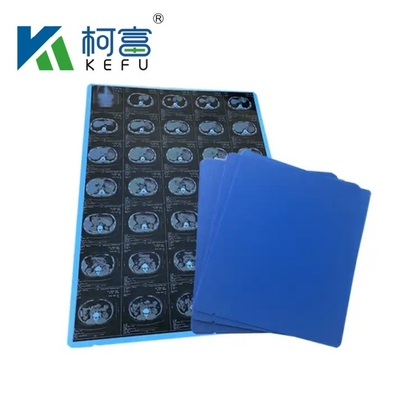 Feuilles de taille personnalisée A3 rouleaux de film médical jet d'encre bleu pour l'impression d'images médicales rayons X CT, CR, DR, MTR