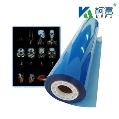 Imagerie médicale bleue à rayons X film sec Hôpital CT Imagerie médicale à jet d'encre imperméable