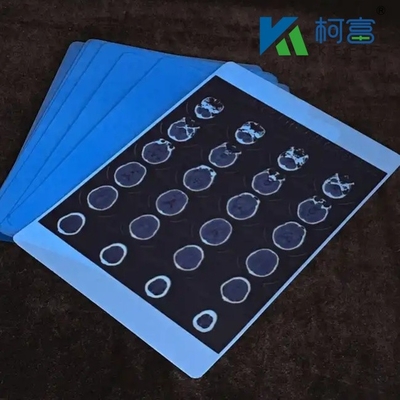 Imagerie médicale bleue à rayons X film sec Hôpital CT Imagerie médicale à jet d'encre imperméable
