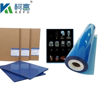 Taille personnalisée 35x43 Film de rayons X médical à jet d'encre bleu pour Epson A4 PET Dry Blue Medical Laser Xray