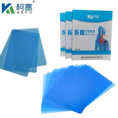 Image médicale bleue Radiographie médicale film sec Hôpital CT Image médicale à jet d'encre imperméable