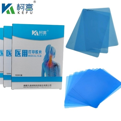 Taille personnalisée Film de rayons X médical à jet d'encre bleu Pour Epson A4 A3 PET Laser médical bleu sec En vente
