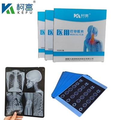 Taille personnalisée Film de rayons X médical à jet d'encre bleu Pour Epson A4 A3 PET Laser médical bleu sec En vente