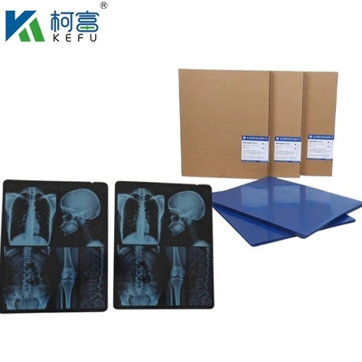 Taille personnalisée Film de rayons X médical à jet d'encre bleu Pour Epson A4 A3 PET Laser médical bleu sec En vente