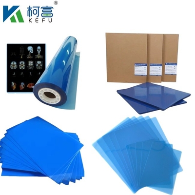 Images médicales personnalisées de taille bleue à base de PET à jet d'encre à rayons X/film laser pour cliniques et hôpitaux