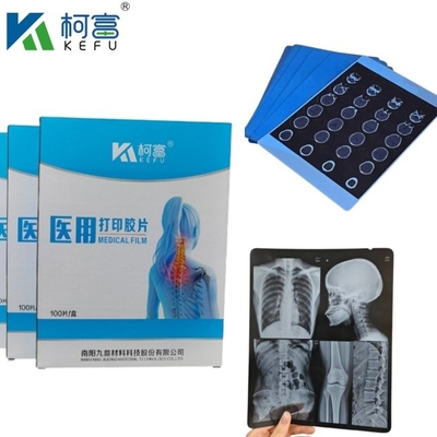 Images médicales personnalisées de taille bleue à base de PET à jet d'encre à rayons X/film laser pour cliniques et hôpitaux