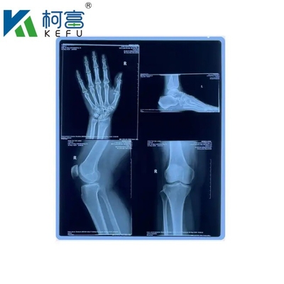 Images médicales personnalisées de taille bleue à base de PET à jet d'encre à rayons X/film laser pour cliniques et hôpitaux