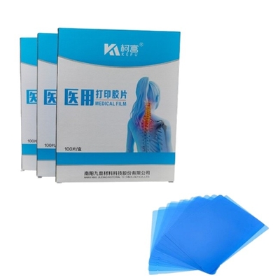 Taille personnalisée Vente à chaud Film médical jet d'encre bleu blanc Film à rayons X Pour les imprimantes à jet d'encre en feuilles