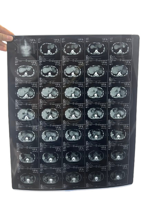 Impression à jet d'encre à rayons X Médical Film d'imagerie à jet d'encre à rayons X sec Pour les dispositifs médicaux