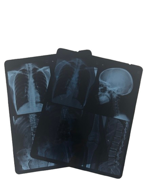 Films pour animaux de compagnie à jet d'encre bleu imperméable à l'eau 8*10 10*12 10*14 pouces PET Xray Blue Sheet Film médical pour impression numérique