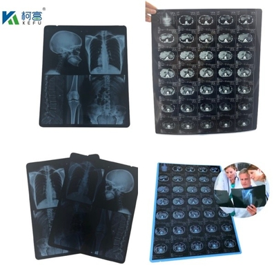 Films pour animaux de compagnie à jet d'encre bleu imperméable à l'eau 8*10 10*12 10*14 pouces PET Xray Blue Sheet Film médical pour impression numérique