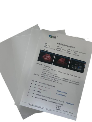 Densité minimale 0,28D Film à rayons X pour des résultats de diagnostic précis et détaillés