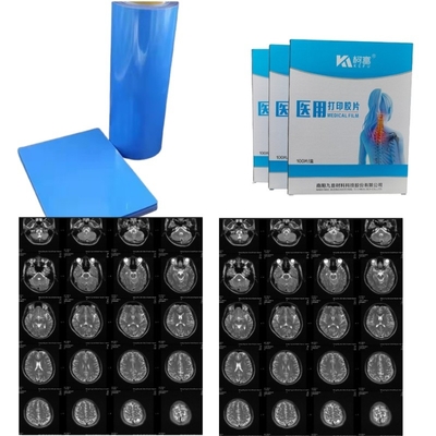 Image médicale séchée PET jet d'encre laser film de rayons X médical 14x17 pouces