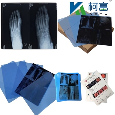 14*17 pouces de film d'analyse à sec pour radiographie médicale/CT/DR pour imprimante laser à rayons X et équipement d'impression thermique