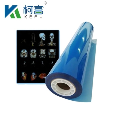 Taille personnalisée Films à rayons X médicaux à jet d'encre bleu et blanc pour imprimantes à jet d'encre en feuilles