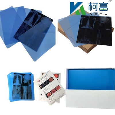 Taille personnalisée Films à rayons X médicaux à jet d'encre bleu et blanc pour imprimantes à jet d'encre en feuilles