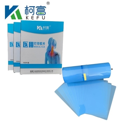 Image médicale PET sèche à jet d'encre Film bleu Film médical à rayons X Taille personnalisée