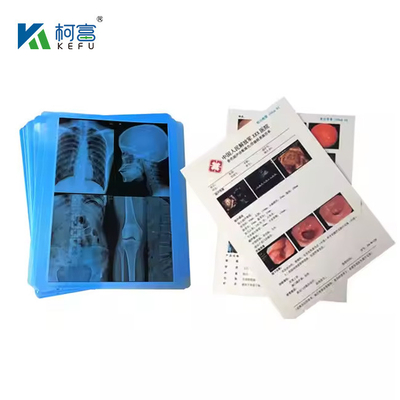 Film laser médical avec une haute précision et fidélité des couleurs 14x18in 0.16mm pour des images de diagnostic vraies à la vie