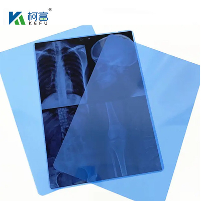 10*12 pouces Film de balayage à sec pour radiographie médicale / CT / DR Pour imprimante laser à rayons X et équipement d'imprimante thermique