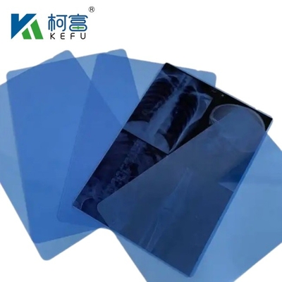 Images médicales à base de rayons X thermiques / jet d'encre à base de PET bleu pour les cliniques et les hôpitaux