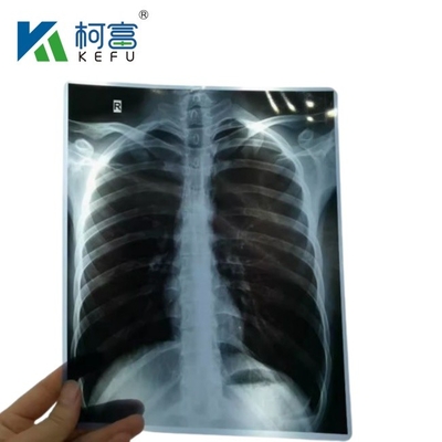 8x10 pouces 14x17 pouces Blue Medical X Ray Film Substitute Fuji Medical Dry Film Pour les cliniques et les hôpitaux