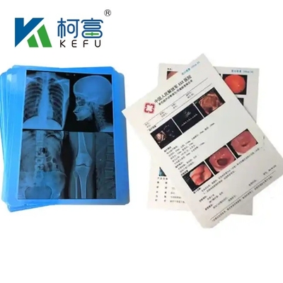 14&quot;*17&quot; Film X de haute qualité pour appareils médicaux hospitaliers
