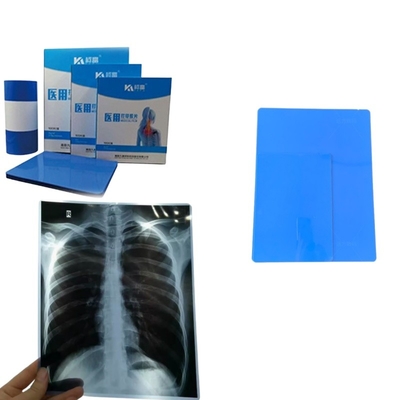 Feuilles de taille A4 Film à jet d'encre bleu à rayons X pour l'imagerie médicale Imprimé rayons X CT CR DR MTR PET