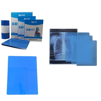 Exemplaire gratuit d'imagerie par jet d'encre de papier à rayons X imprimé par imprimante pour la radiologie Diagnostic médical 8*10 imprimante