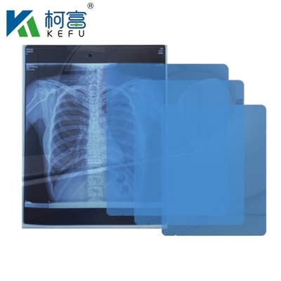 8x10 10x12 10x14 14x17 pouces de film de DIHL sec médical film laser pour clinique et hôpitaux