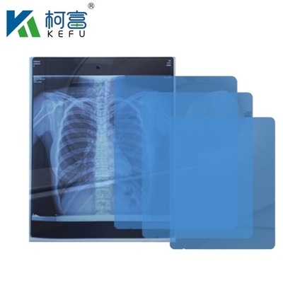 Imagerie médicale haute définition CT DR Inkjet Medical X-ray Pet Film 175mic 215mic Film d'impression bleu transparent