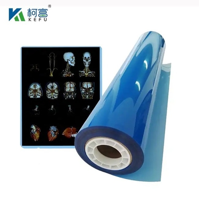 Film laser médical haute définition et large gamme 17x22in 0.17mm pour des examens médicaux détaillés et vifs