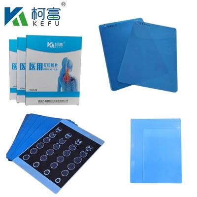 Vente en gros de films à jet d'encre médicaux internationaux Film bleu à rayons X Films thermiques pour cliniques et hôpitaux