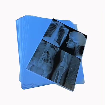 Notre film de rayons X bleus médicaux professionnellement produit pour l'impression laser est le choix.