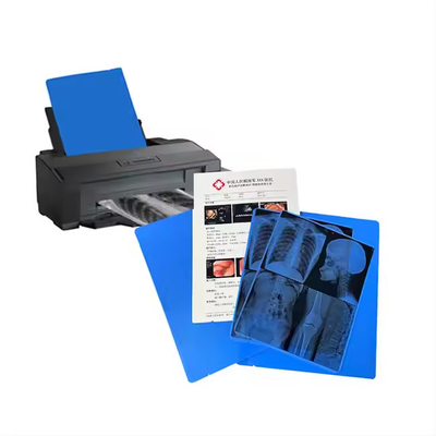 Film bleu médical à rayons X pour l'impression laser et le diagnostic précis