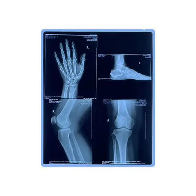 11*14 Taille de film de rayons X bleu médical pour l'impression laser