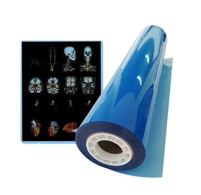 11*14 Taille de film de rayons X bleu médical pour l'impression laser