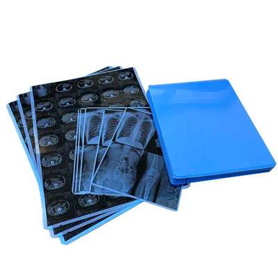 Disponible une pellicule de rayons X bleu médical produite par des professionnels pour l'impression au laser