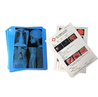 Film bleu médical à rayons X pour l'impression au laser de consommables médicaux hospitaliers