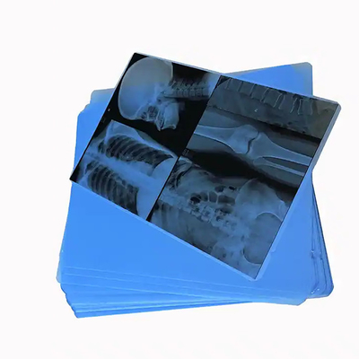 Film bleu médical à rayons X pour l'impression au laser de consommables médicaux hospitaliers