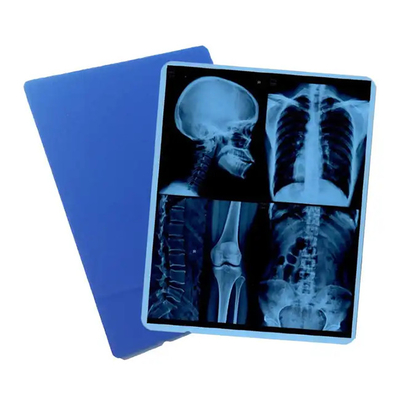 Film bleu médical à rayons X pour l'impression au laser de consommables médicaux hospitaliers