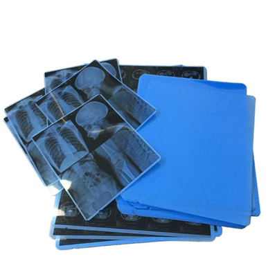 Production de pointe de film bleu médical à rayons X pour l'impression laser produit par des professionnels