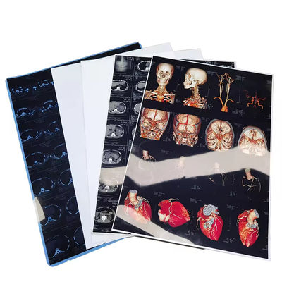 Films de rayons X médicaux bleu blanc haute résolution avec finition de surface brillante