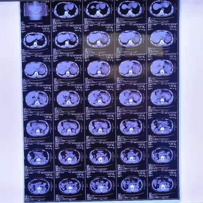 Coût raisonnable Films de rayons X médicaux offrant une grande stabilité d'image fournissant des images de diagnostic médical claires et précises